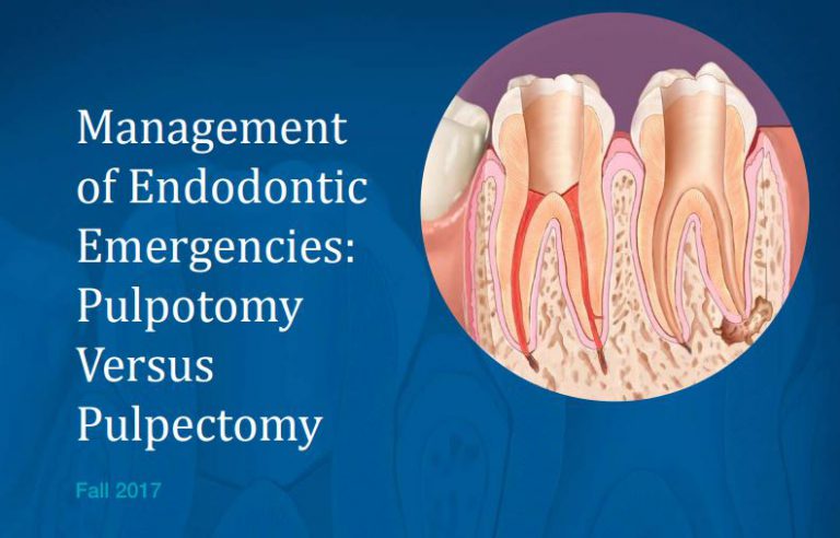 Cover of the Fall 2017 Endodontics: Colleagues for Excellence newsletter