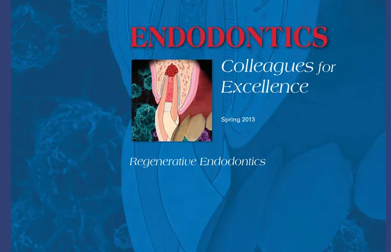 Cover of the Spring 2013 Endodontics: Colleagues for Excellence newsletter